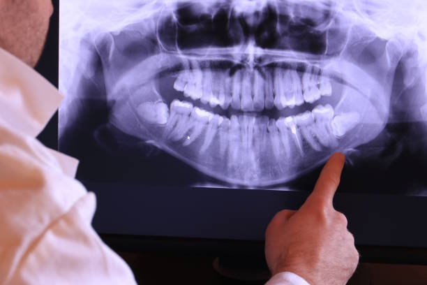 Best Emergency Gum Treatment in Carpendale, WV