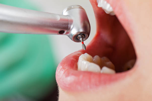 Best Weekend Emergency Dentist in Carpendale, WV